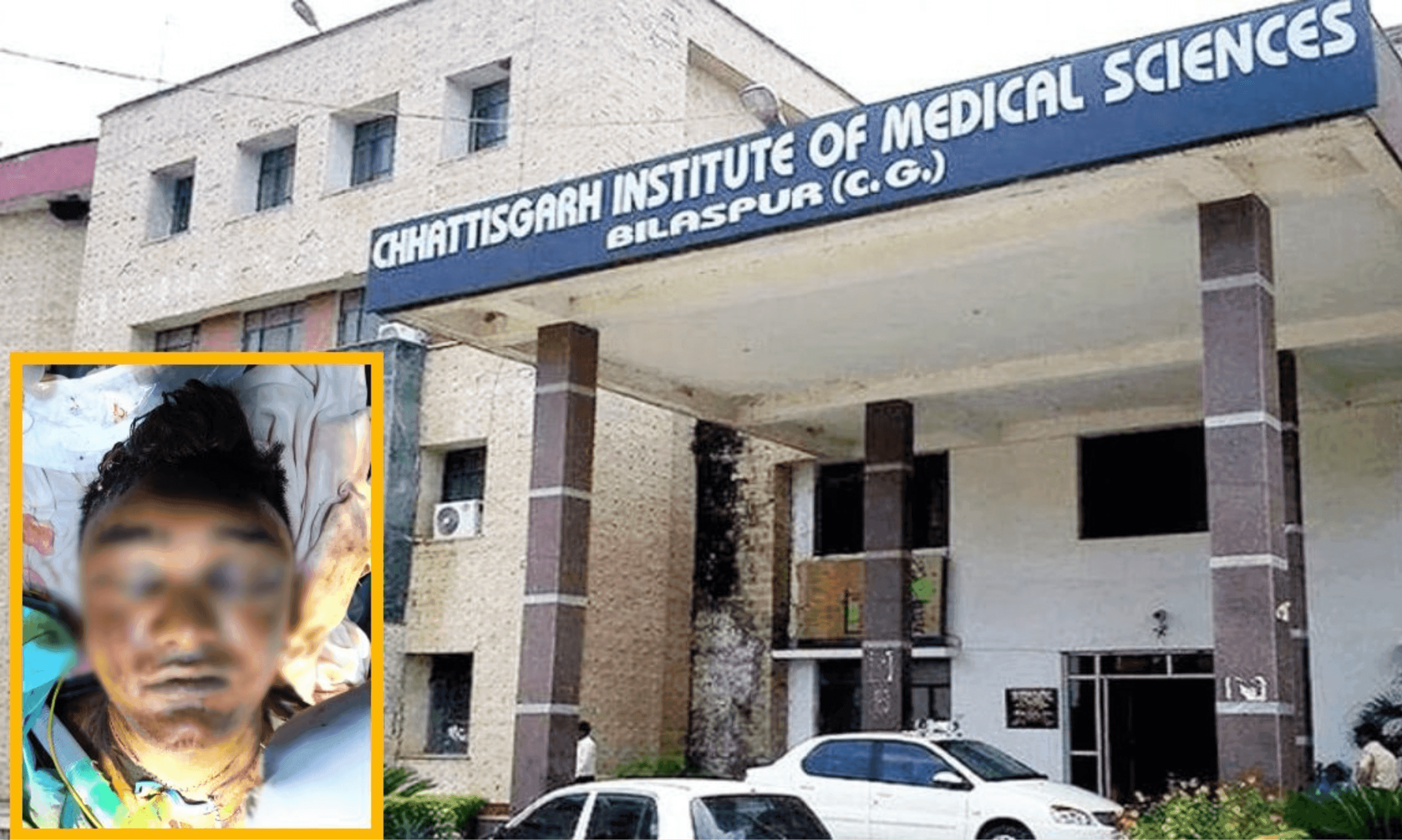 सिम्स के डॉक्टरों का कमाल: गला कटी हालत में पहुंचे 26 वर्षीय युवक को दिया जीवनदान, 5 परतों में जोड़ी श्वासनली